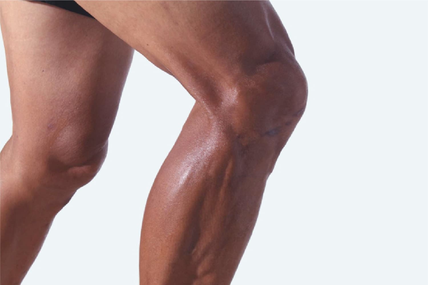 男性の太ももの筋肉